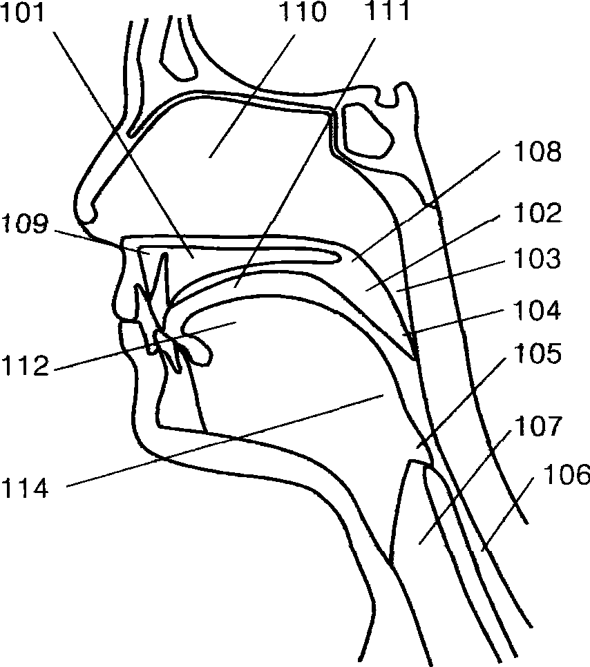 Embedded soft palate supporter and embedding method thereof