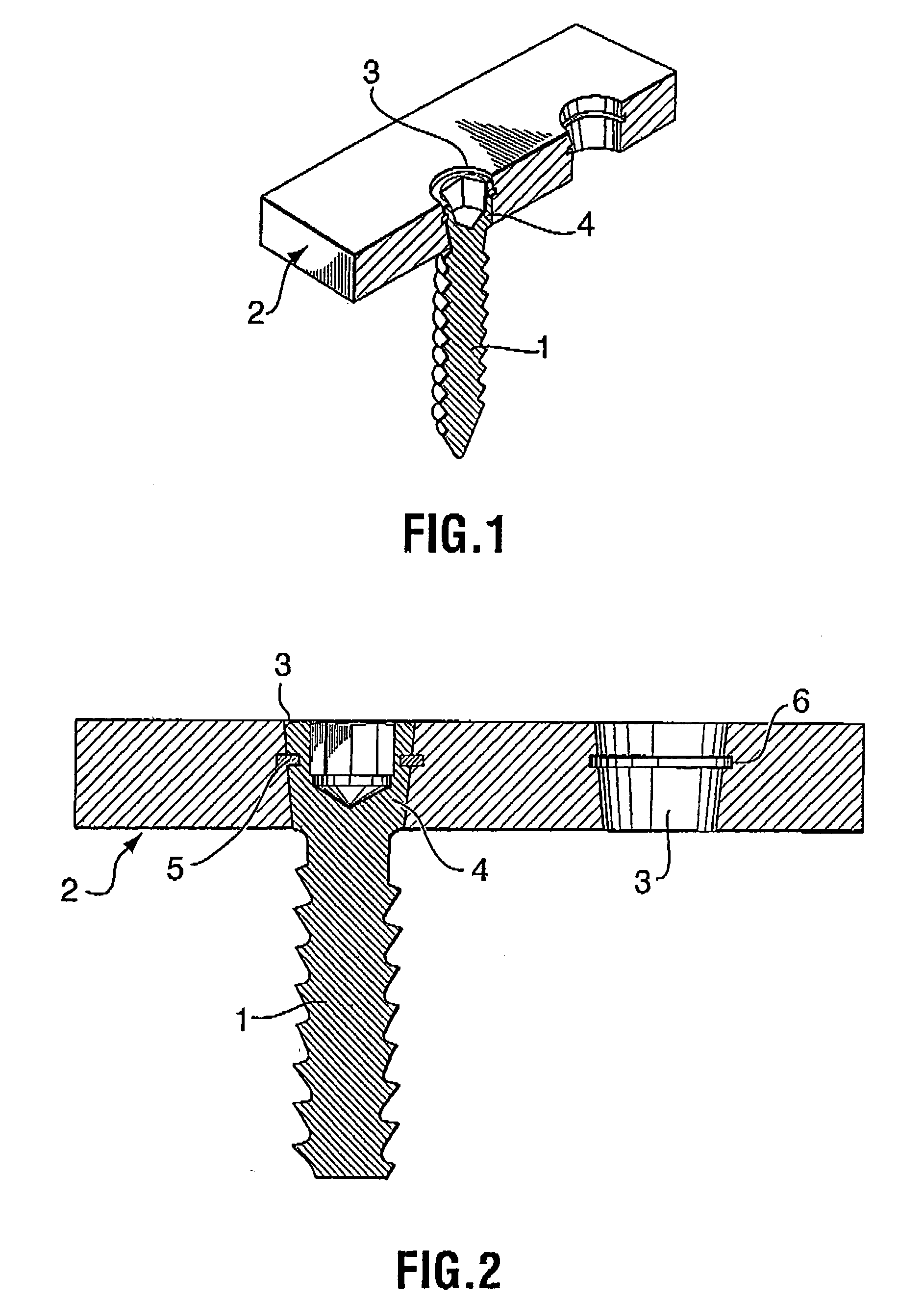 Bone plate and bone screw system