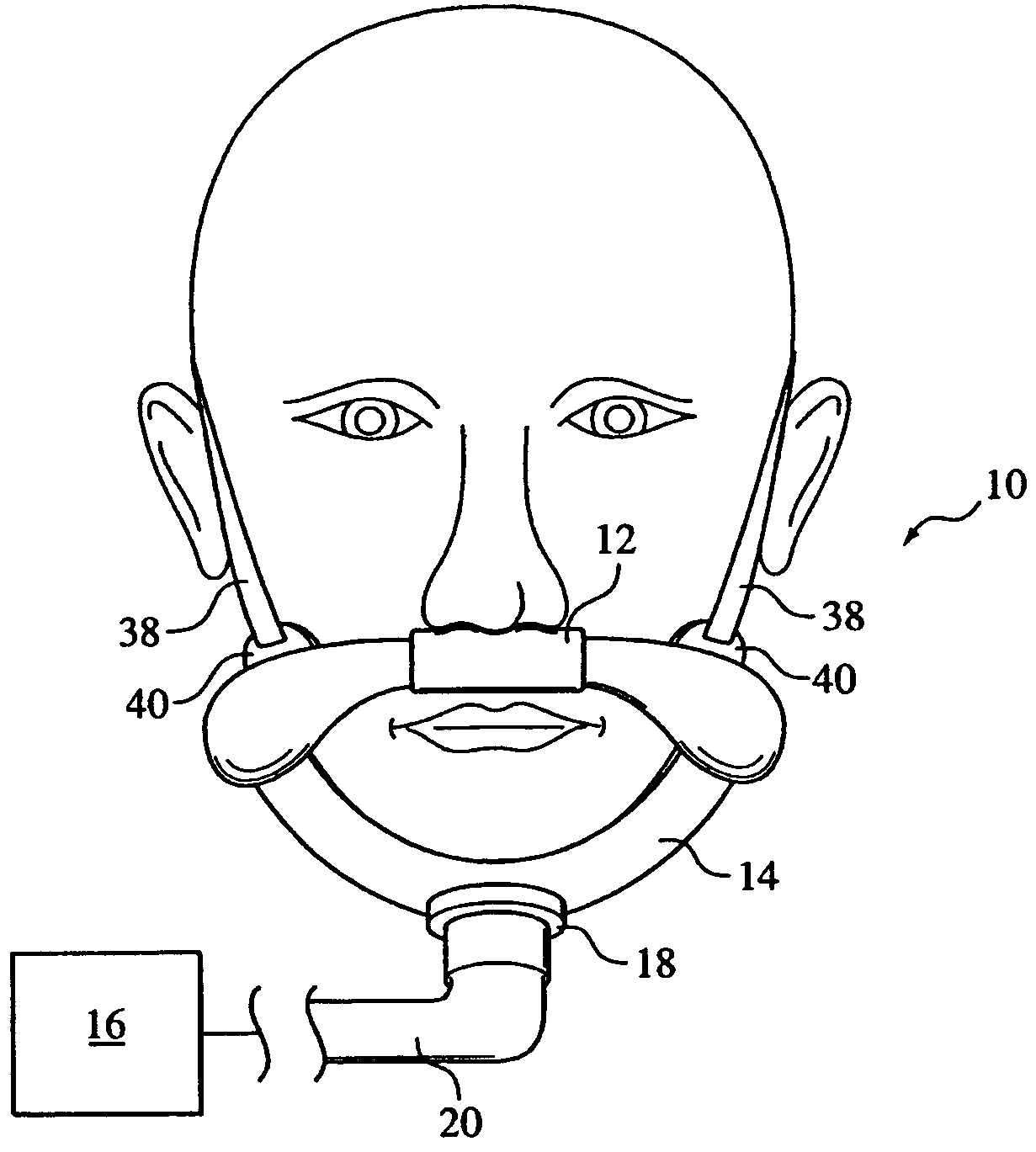 Patient interface assembly supported under the mandible