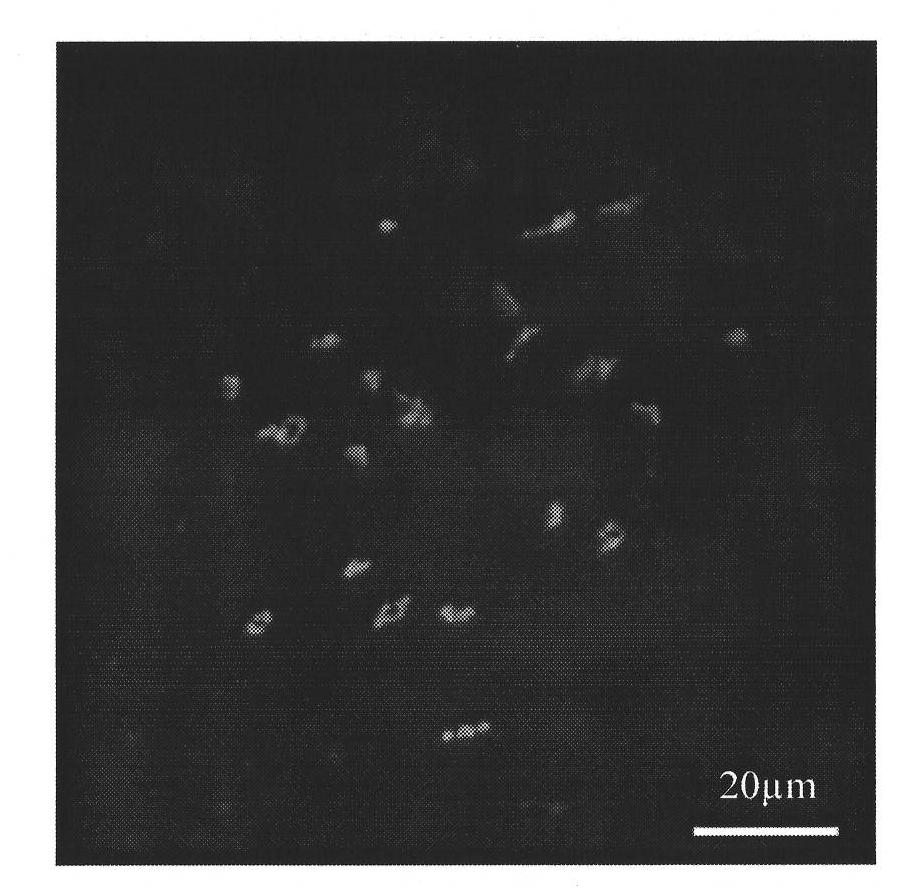 Method for preparing fish ovary germ cell chromosome