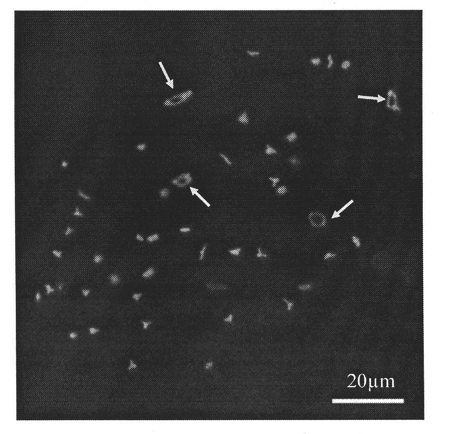 Method for preparing fish ovary germ cell chromosome