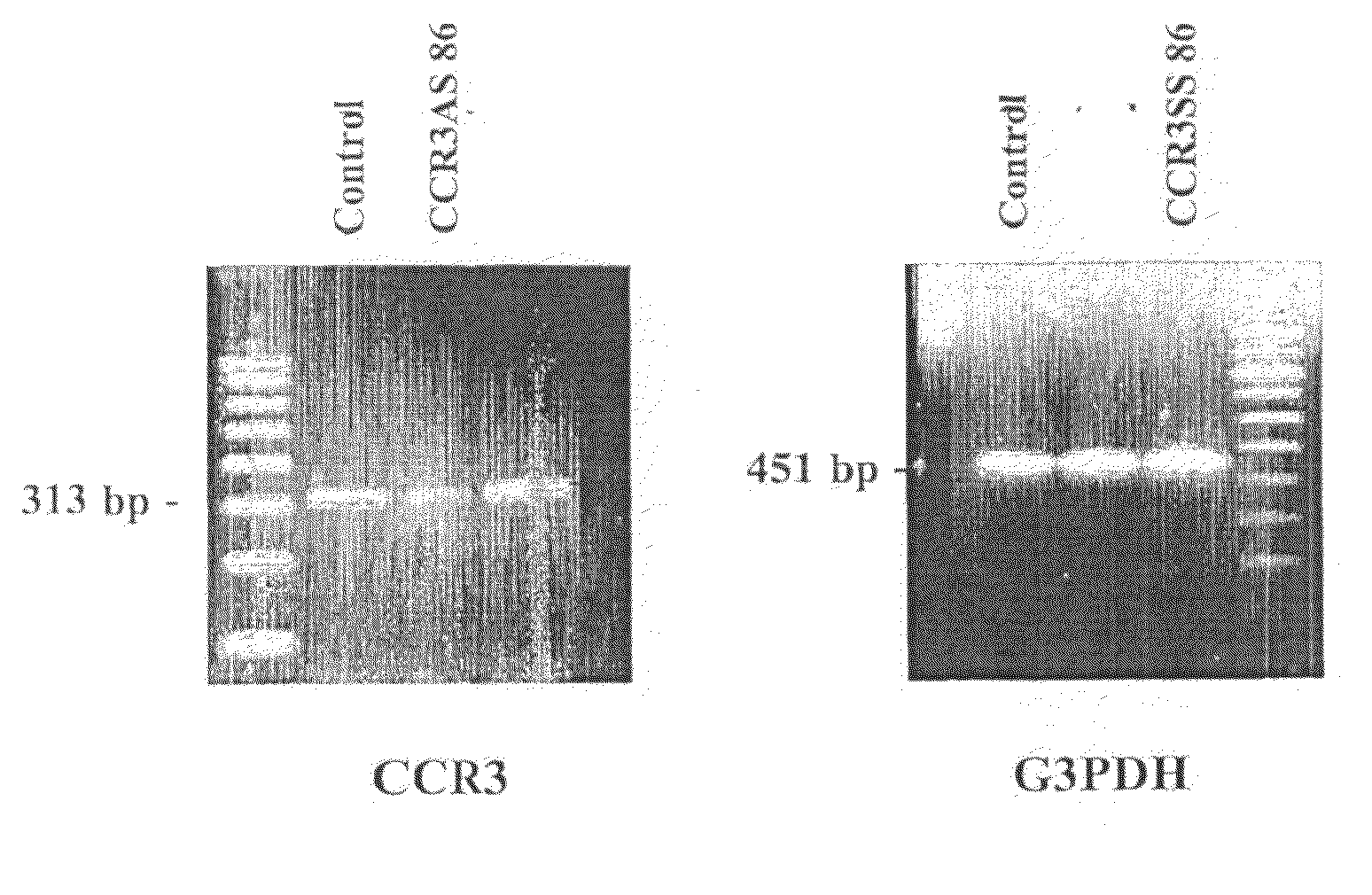 Antisense oligonucleotides for treating allergy and neoplastic cell proliferation