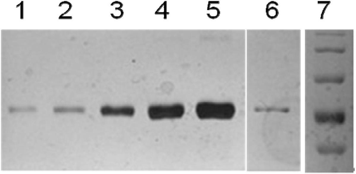 Diagnostic kit and application of coiled-coil domain containing protein 49 (CCDC49) in preparing gastric cancer early-stage diagnostic reagent