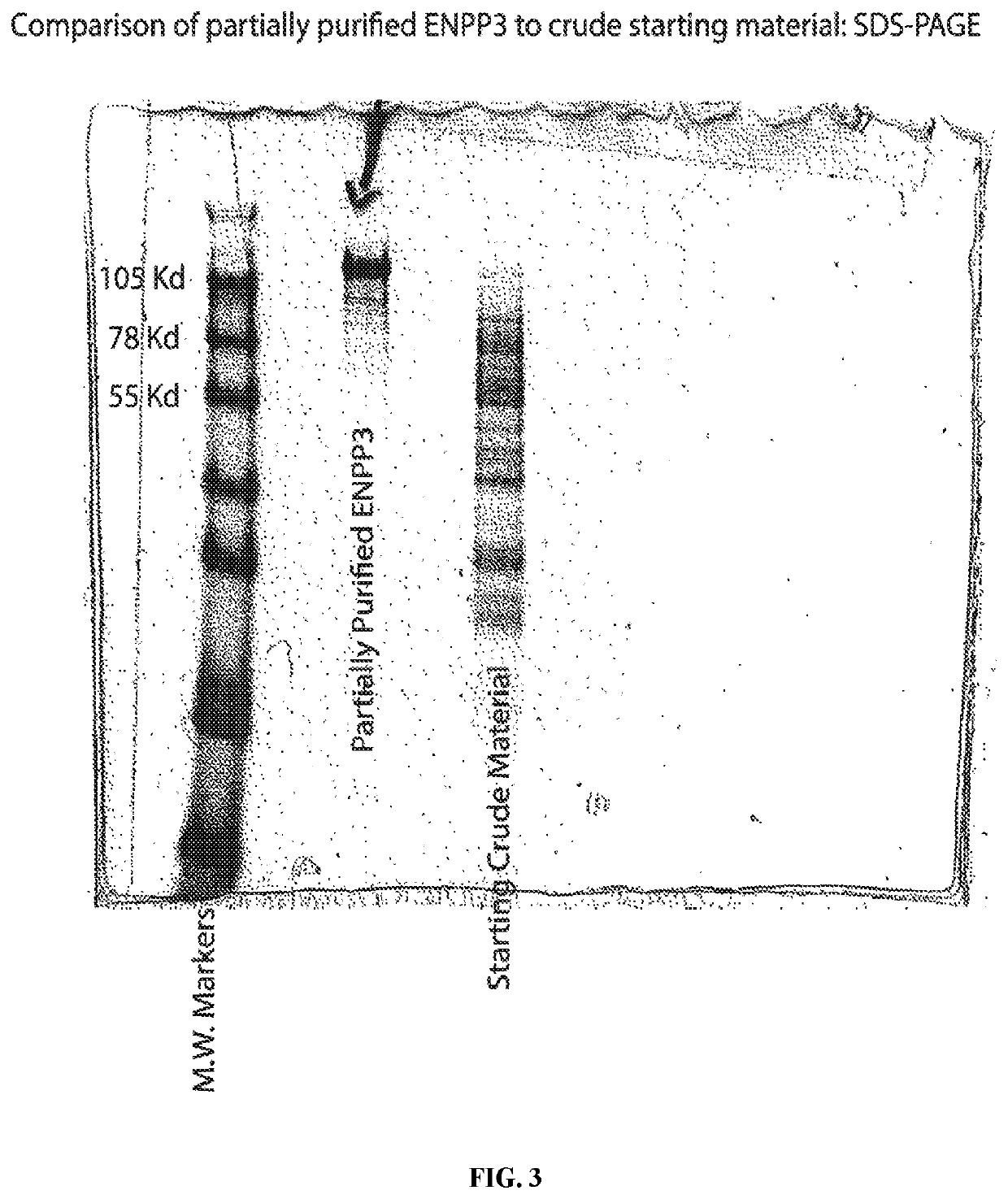 Compositions and methods for stroke prevention in pediatric sickle cell anemia patients