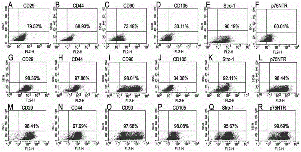 Cultural method of crest-derived stem cell of cranial nerve and identification method