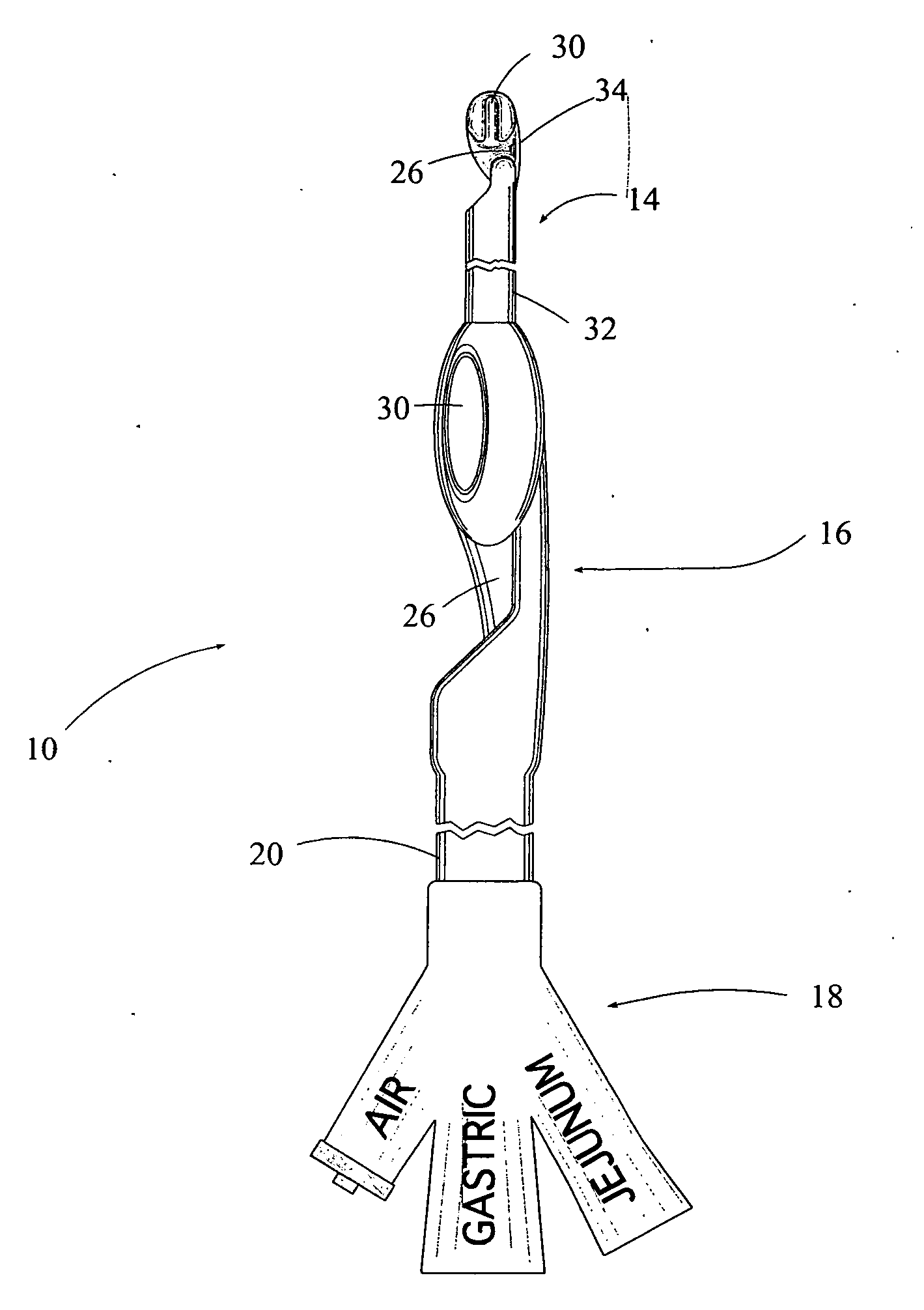 Jejunal feeding catheter