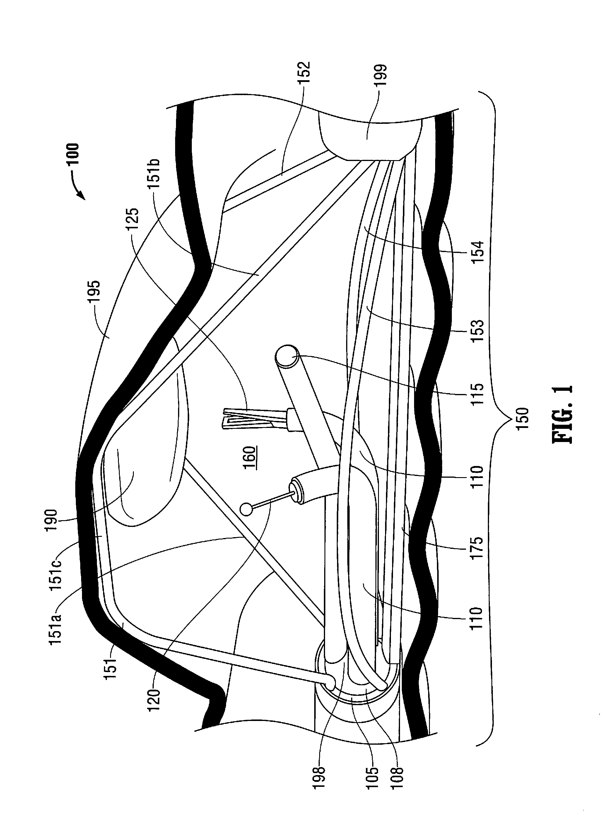 System for a minimally-invasive, operative gastrointestinal treatment