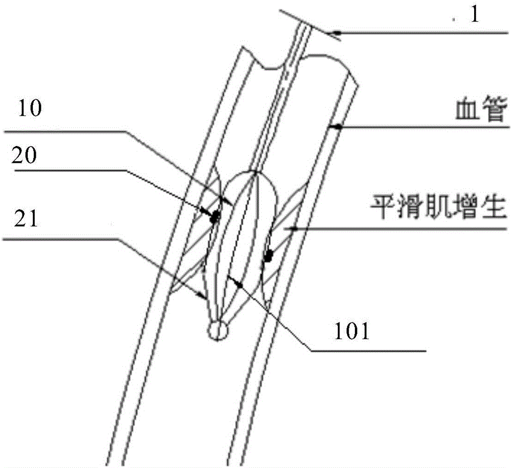 Catheter with both balloon dilatation function and radiofrequency ablation function and ablation method thereof