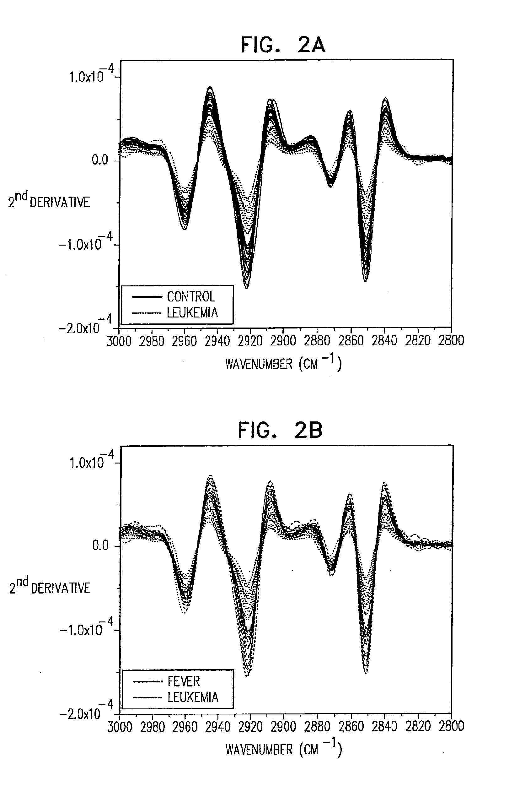 Method and system for detecting and monitoring hematological cancer