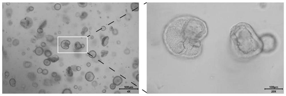 A kind of endometrial organoid culture medium and culture method