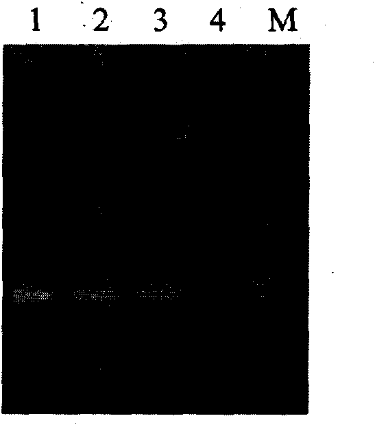 Gene for mediating drug resistance of vancomycin and application thereof