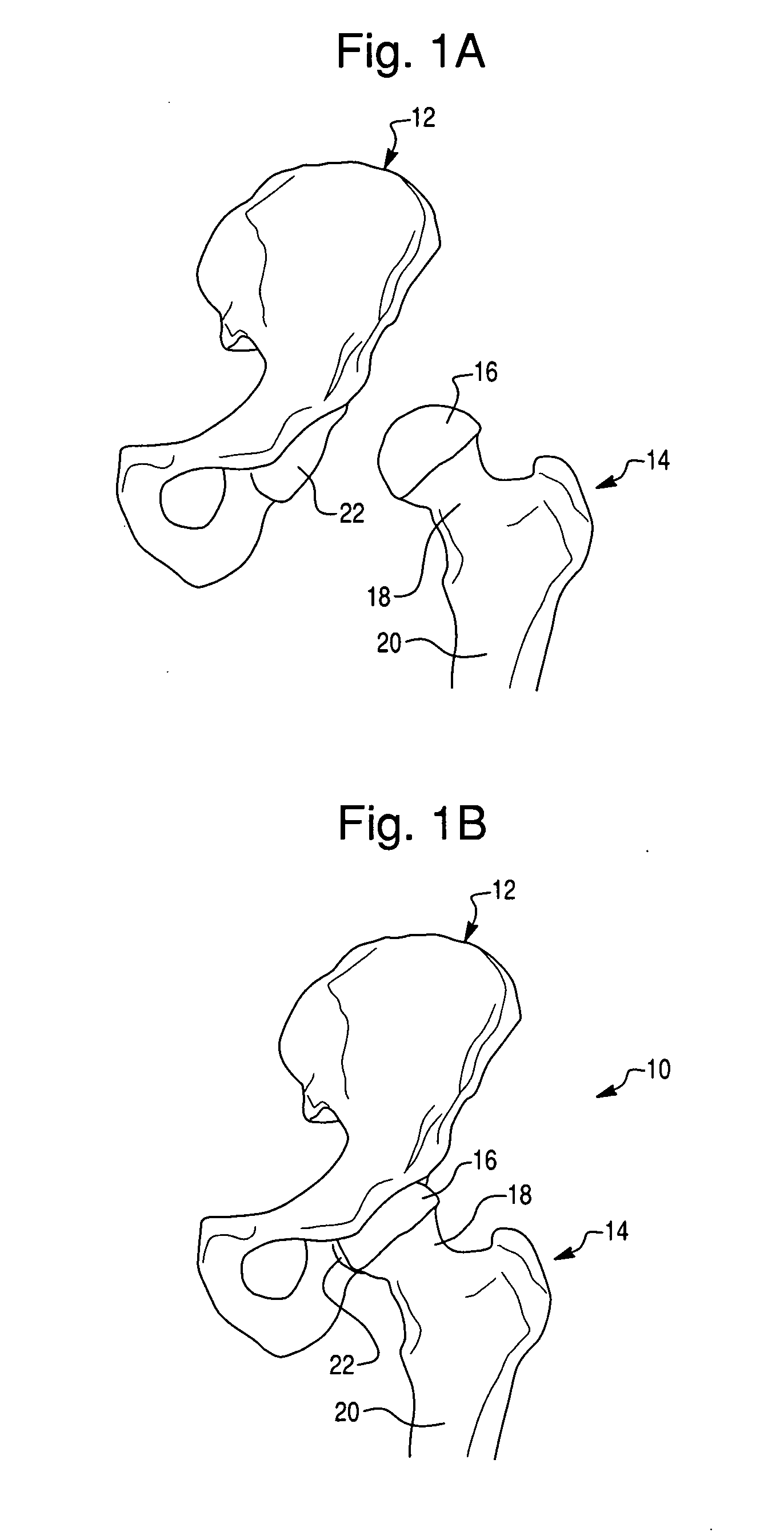 System with brake to limit manual movement of member and control system for same