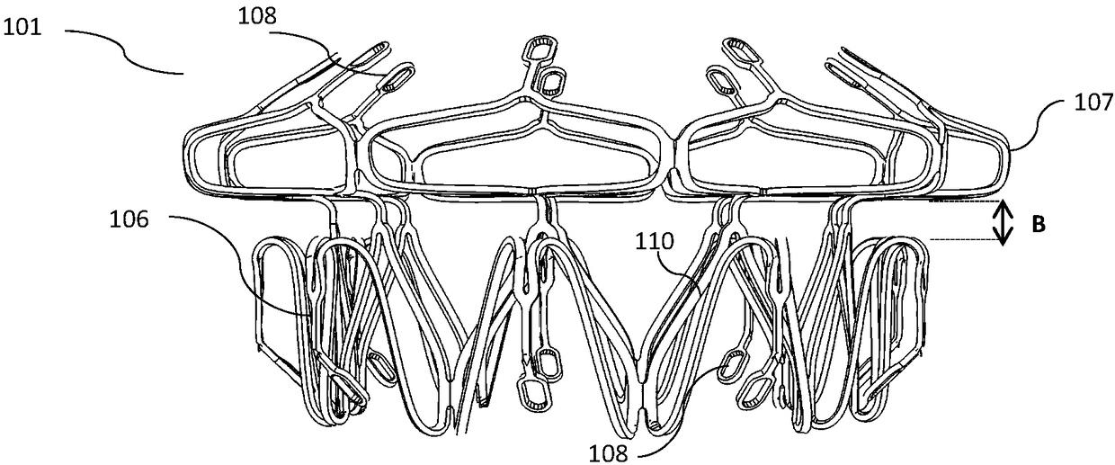 Transapical implantable mitral valve device