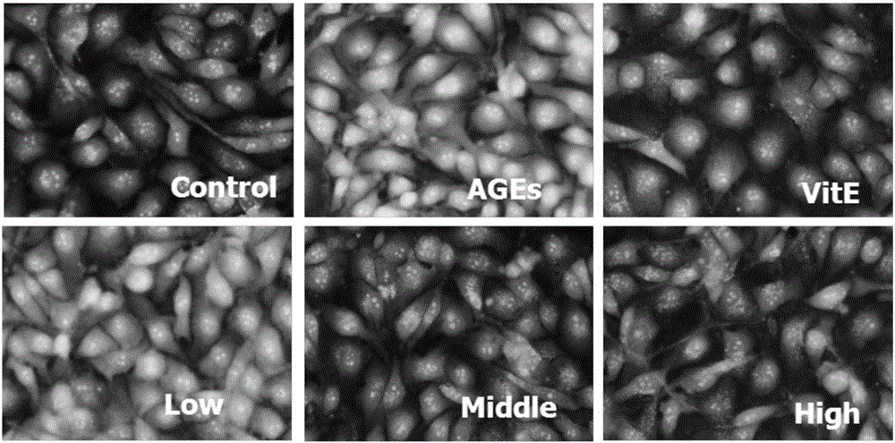 Application of 3,4,5-trimethoxy phenol in preparation of drugs for preventing and treating diabetic nephropathy