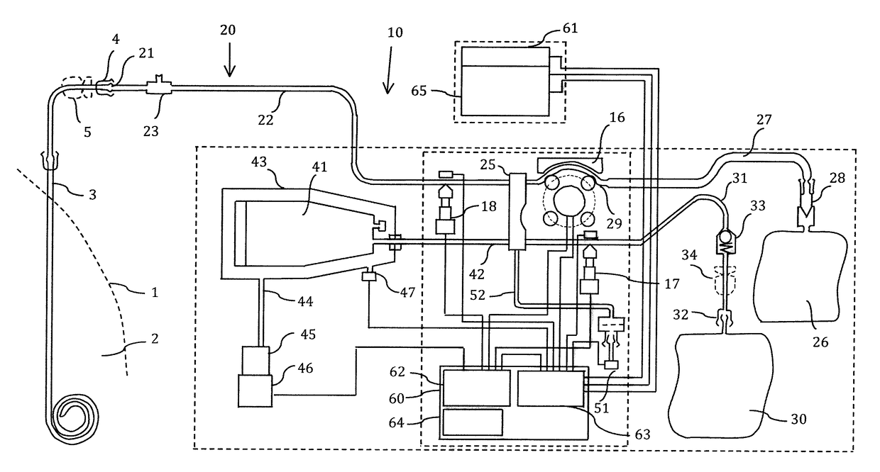 Apparatus for performing peritoneal ultrafiltration