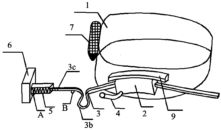 Preparation method of a restoration device for early loss of space between children's replacement dentition