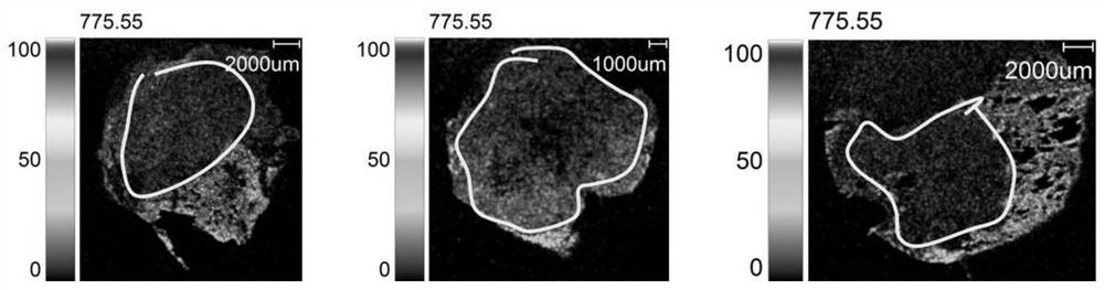 Lung cancer typing judgment system based on mass spectrum imaging technology