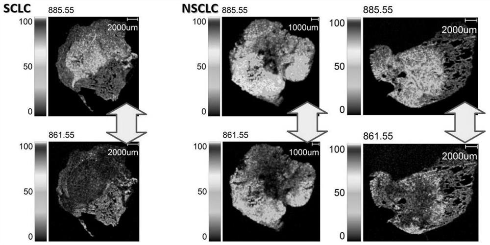 Lung cancer typing judgment system based on mass spectrum imaging technology