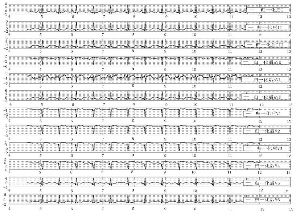 Analysis method, device, storage medium and processor of electrocardiographic signal