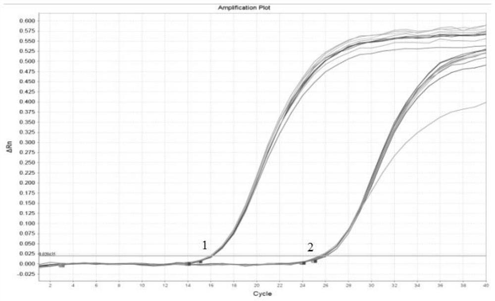 Primer group and kit for detecting mRNA expression of cationic protein of human eosinophilic granulocyte