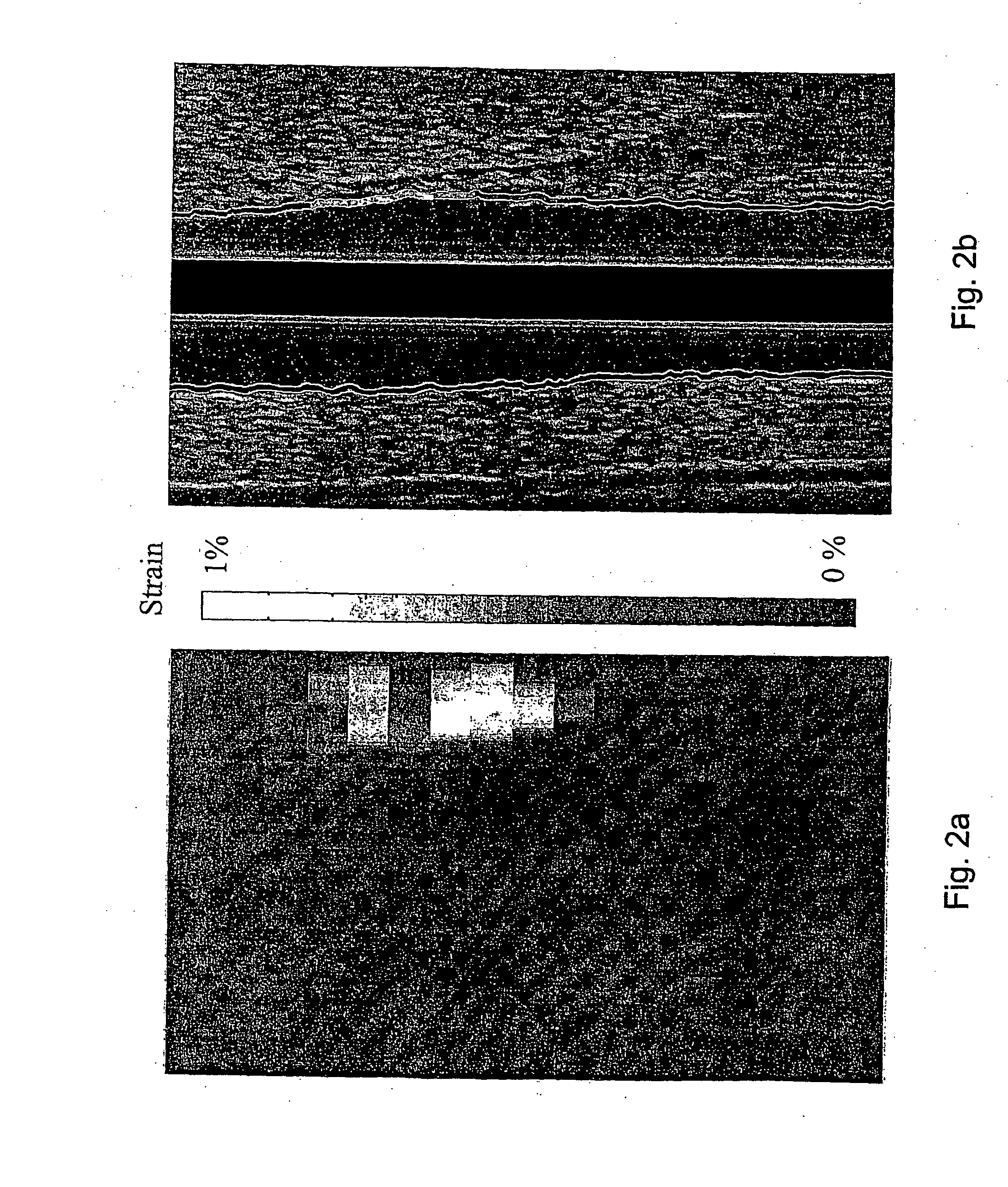 Three-dimensional tissue hardness imaging