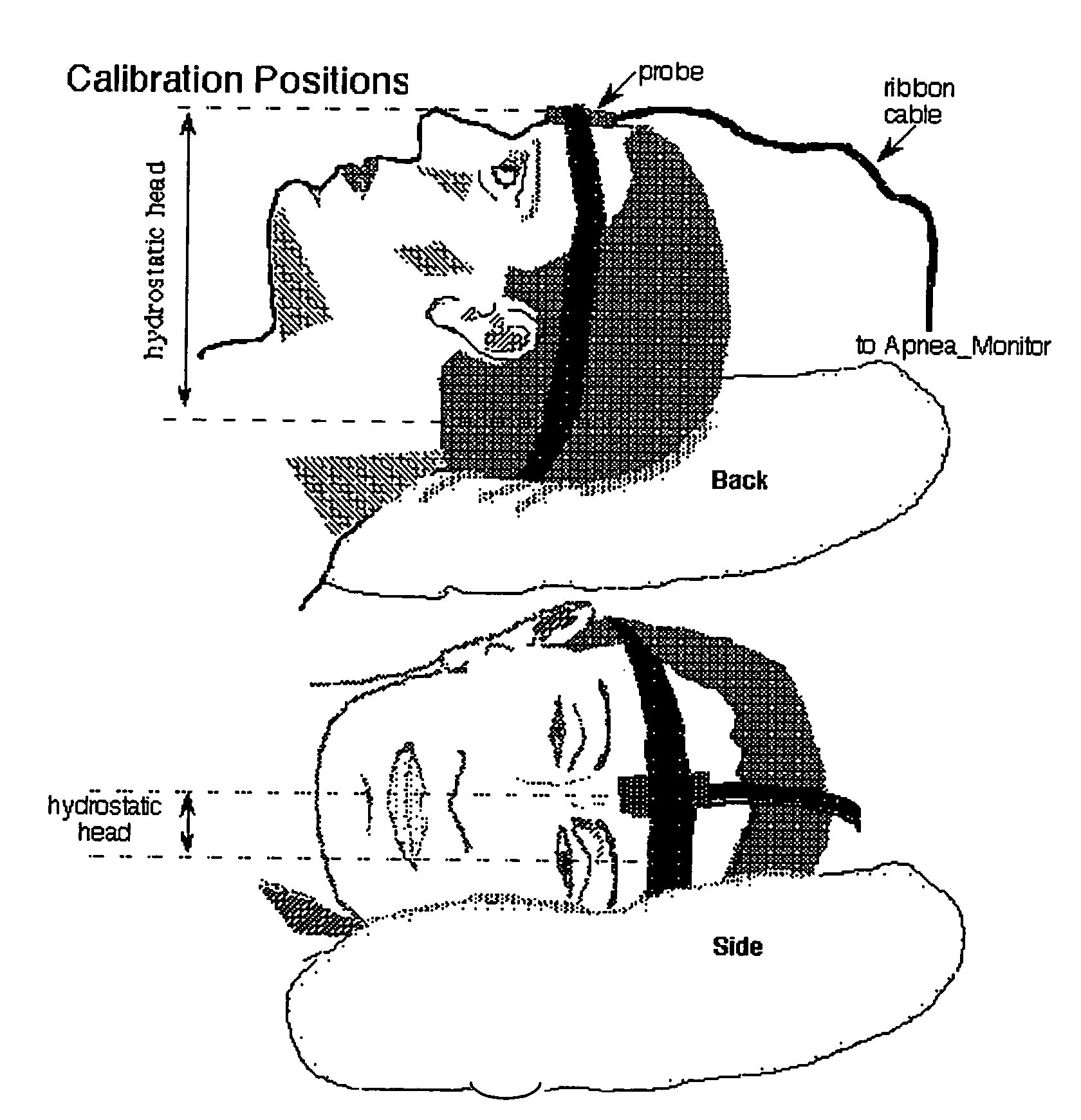 Methods and apparatus for patient monitoring