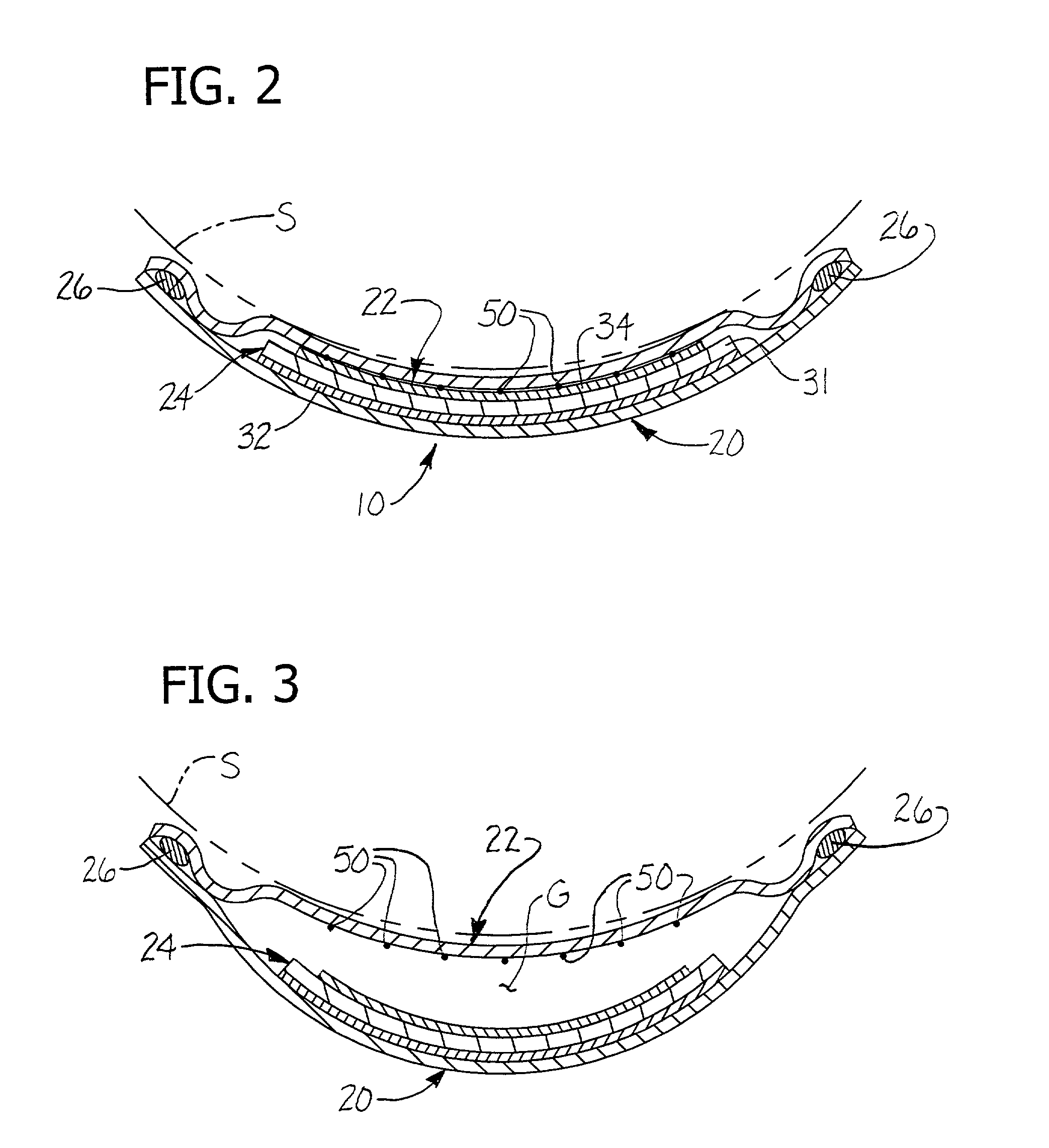 Absorbent articles with absorbent pad gapping