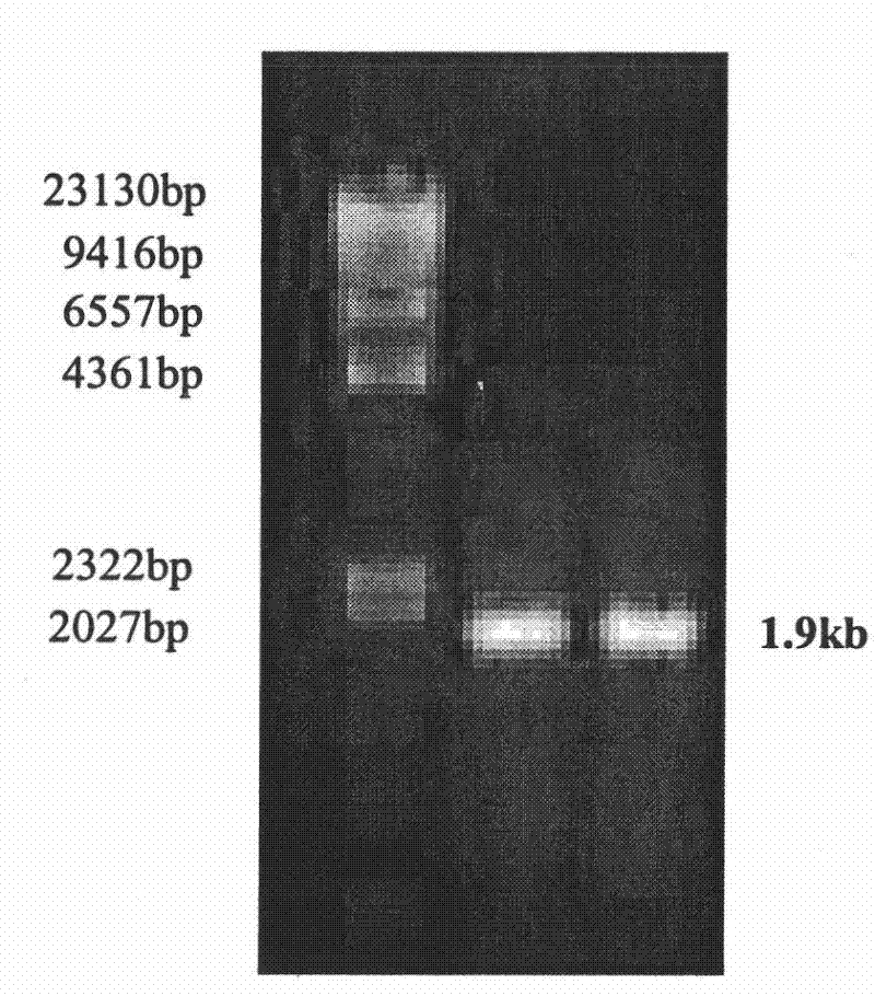 Acid resistant medium temperature alpha-amylase and preparation method thereof