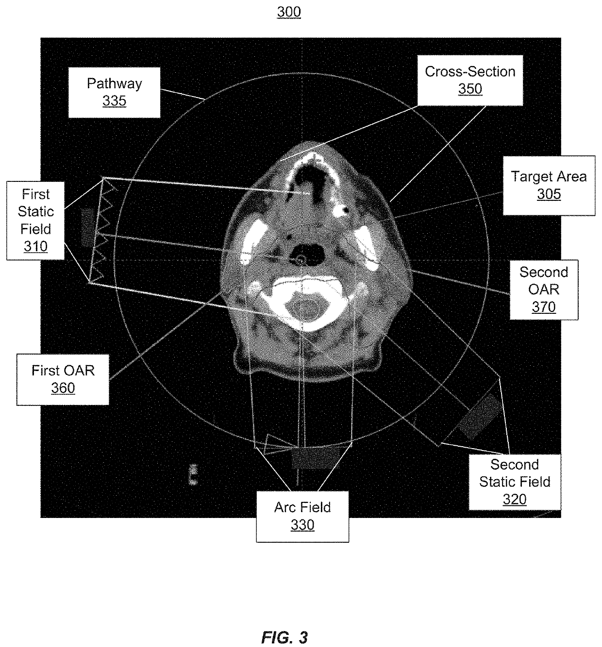 Creating treatment field using initial field and patient specific geometry and achievable dose