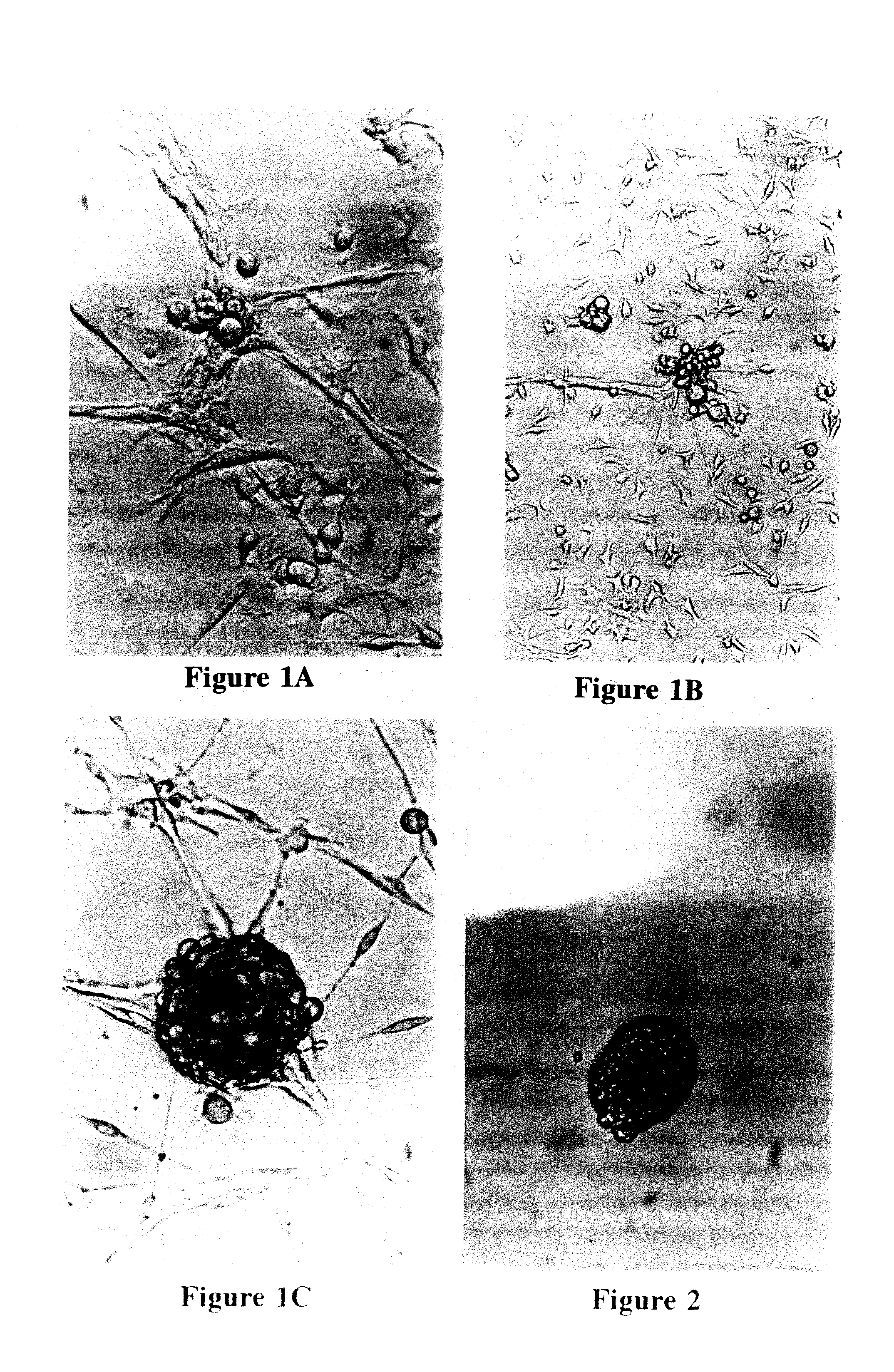 Reversal of insulin-dependent diabetes by islet-producing stem cells, islet progenitor cells and islet-like structures