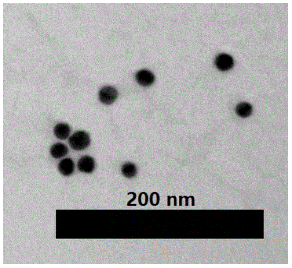 Microbial detection method based on immunomagnetic separation and urease catalysis