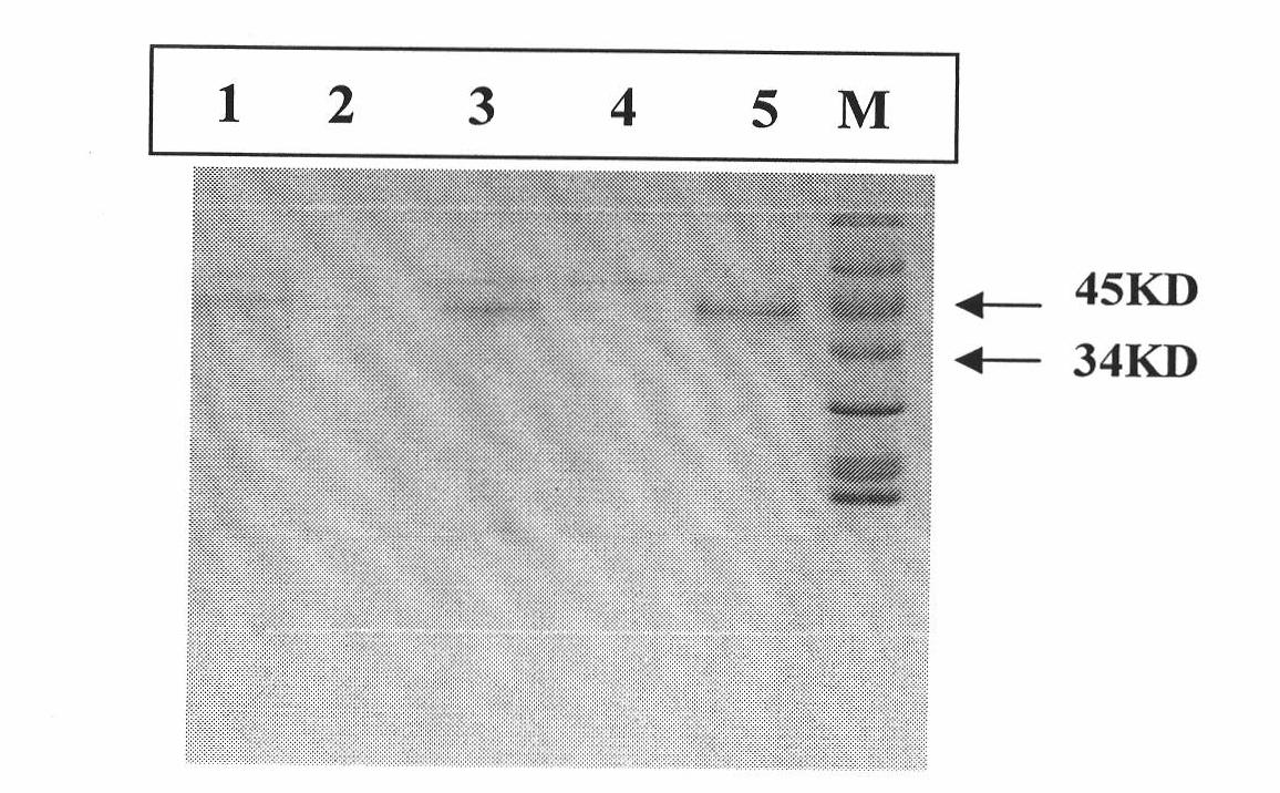 Synthetic method of enterokinase light chain gene and preparation method of expression product of enterokinase light chain gene