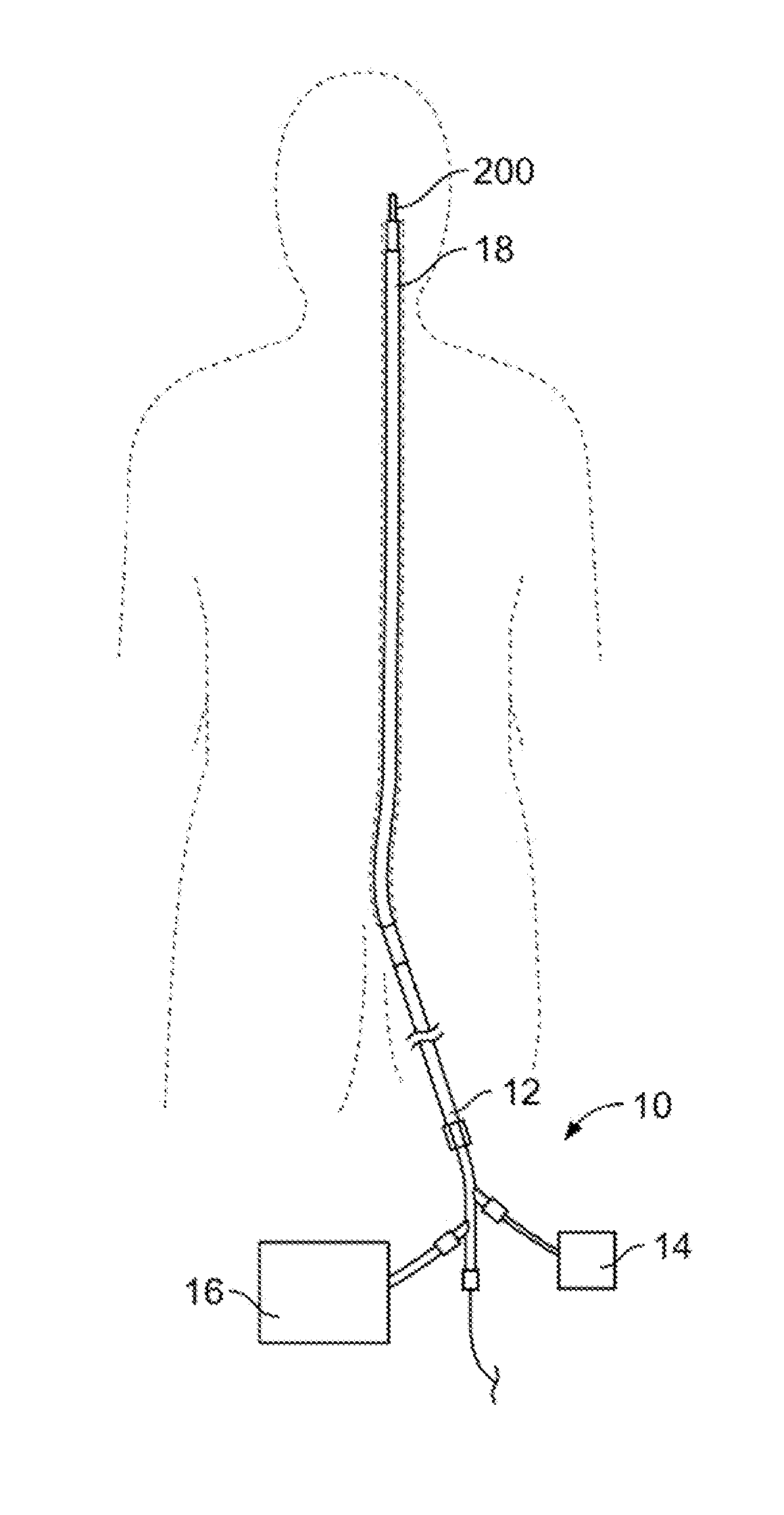 Retrieval systems and methods for use thereof