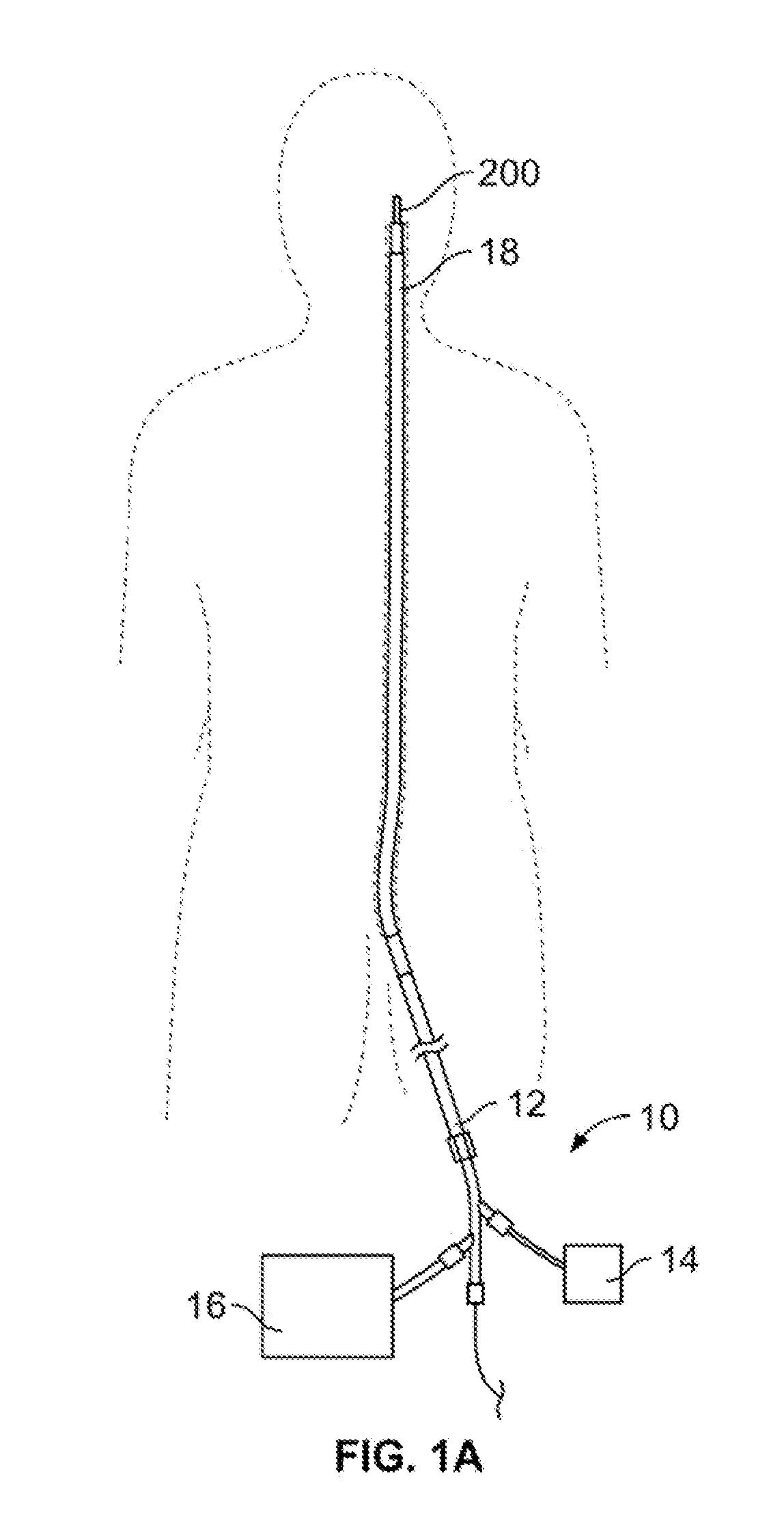 Retrieval systems and methods for use thereof