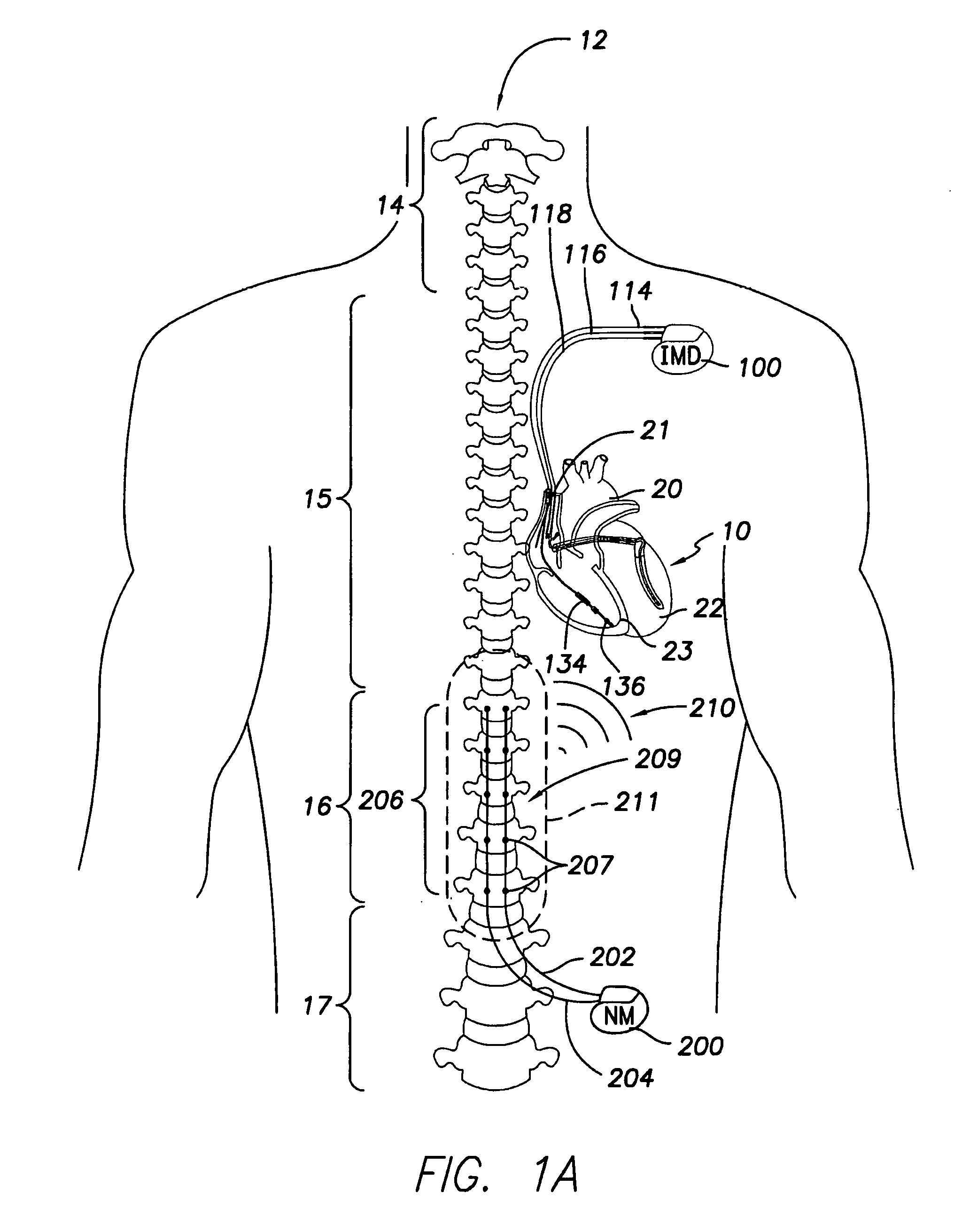 Neurostimulation device and methods for controlling same