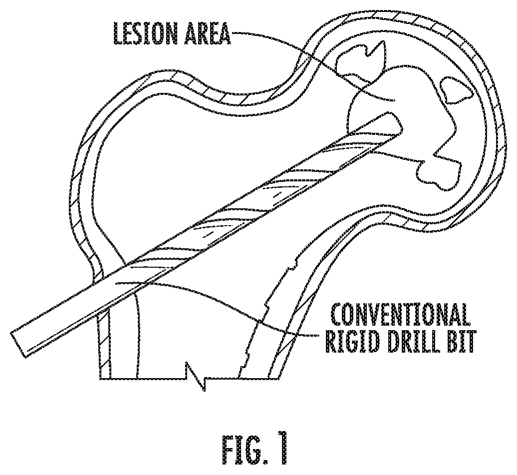 Steerable drill for minimally-invasive surgery