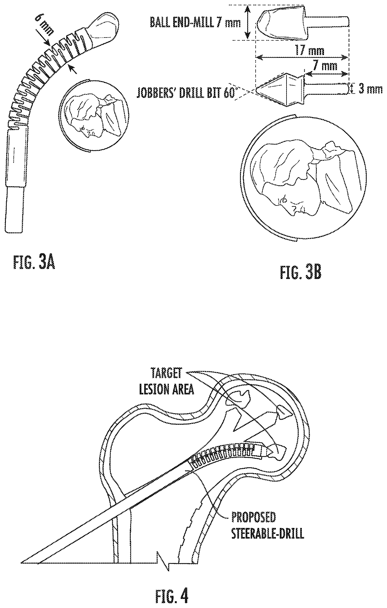 Steerable drill for minimally-invasive surgery