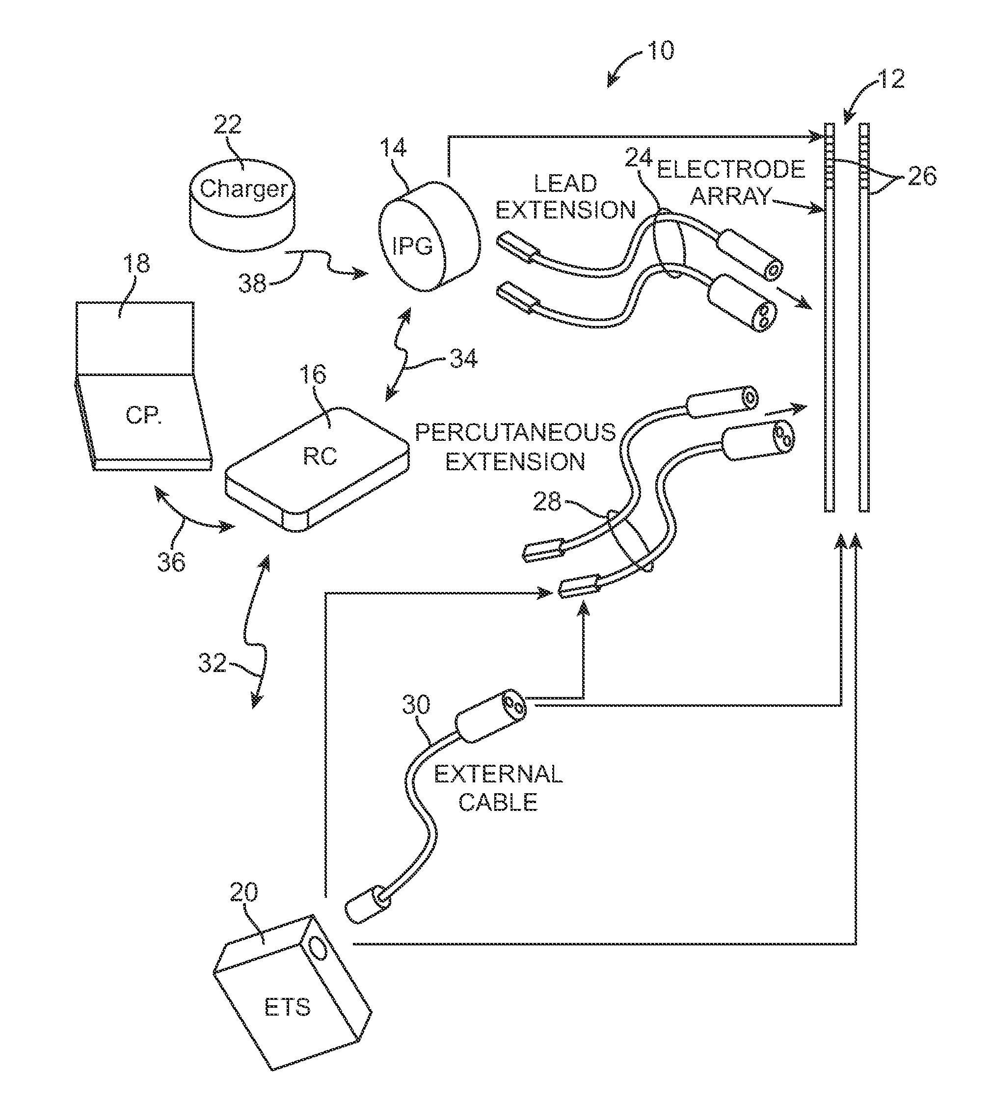 Methods to avoid frequency locking in a multi-channel neurostimulation system using pulse shifting