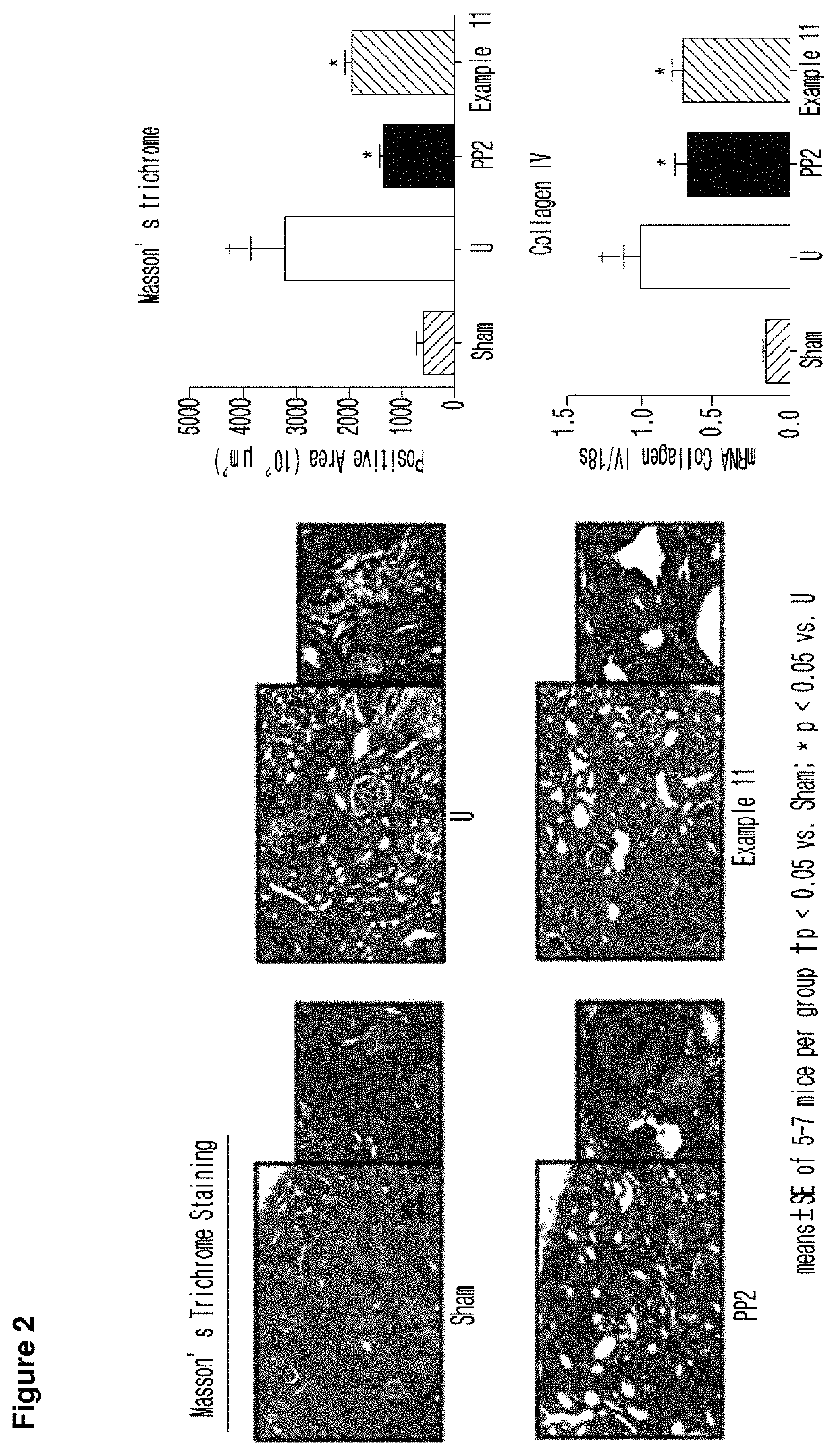 Imidazopyridine derivative, method for preparing same, and pharmaceutical composition containing same as active ingredient for preventing or treating cancer