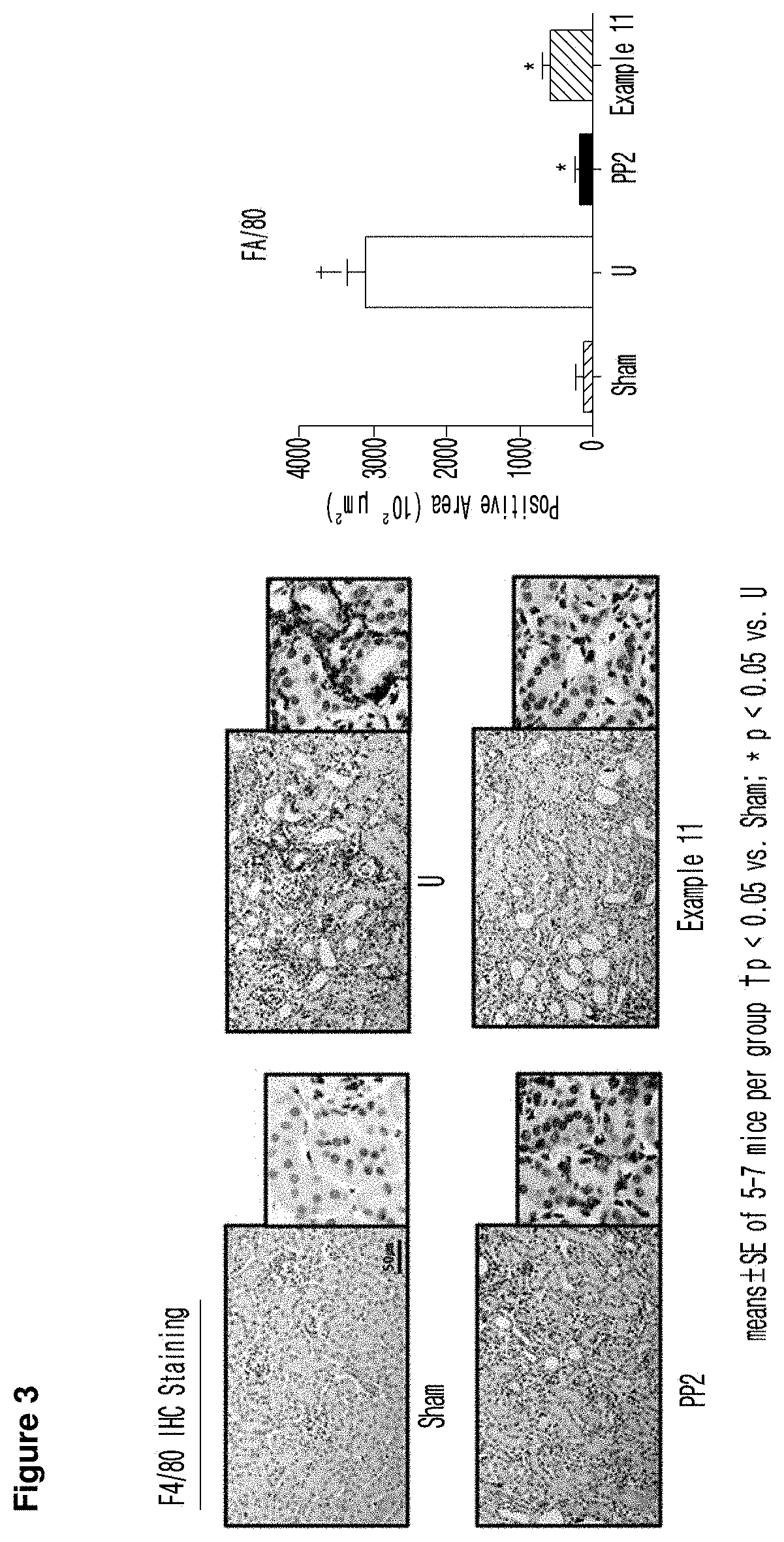 Imidazopyridine derivative, method for preparing same, and pharmaceutical composition containing same as active ingredient for preventing or treating cancer