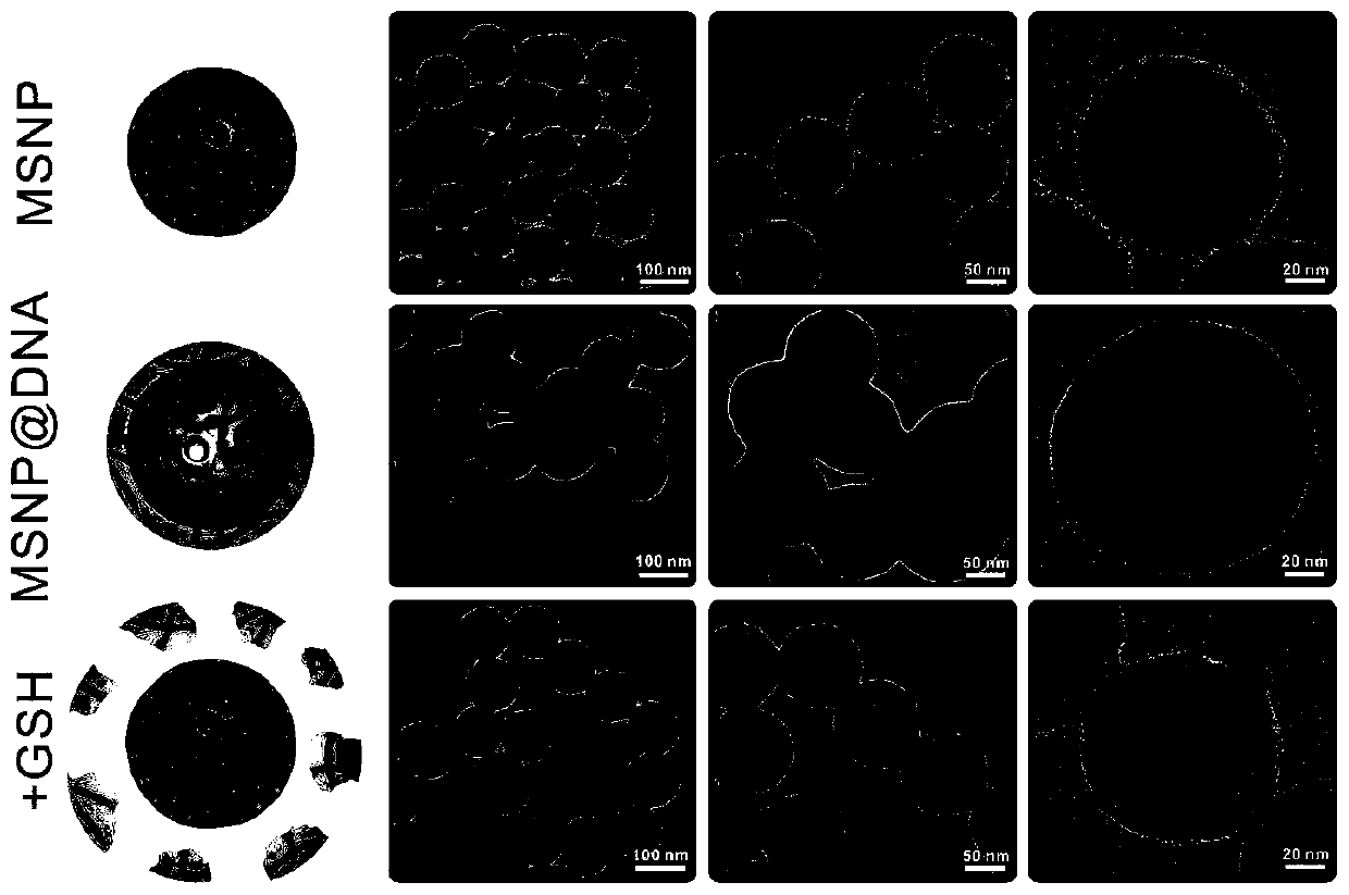 Mesoporous silica-based nano-drug delivery system capable of regulating drug release as well as construction and application of nano-drug delivery system