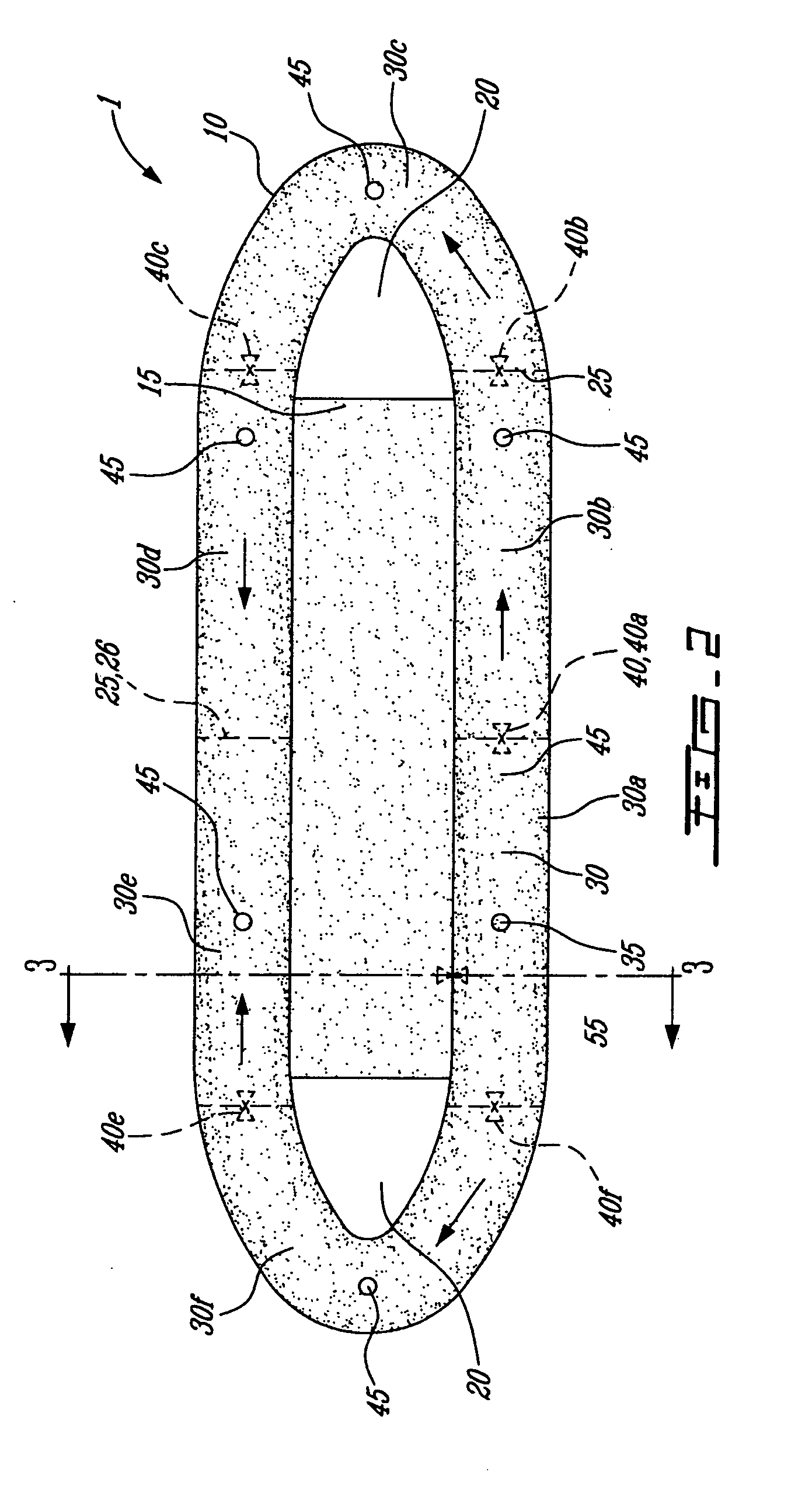 Inflatable structure