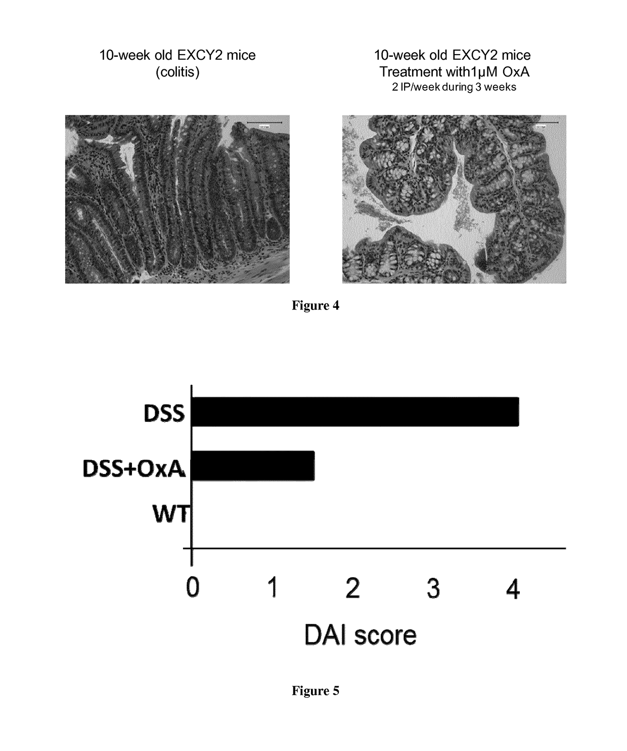 Method of treating an inflammatory bowel disease comprising agonists of orexin-1 receptor