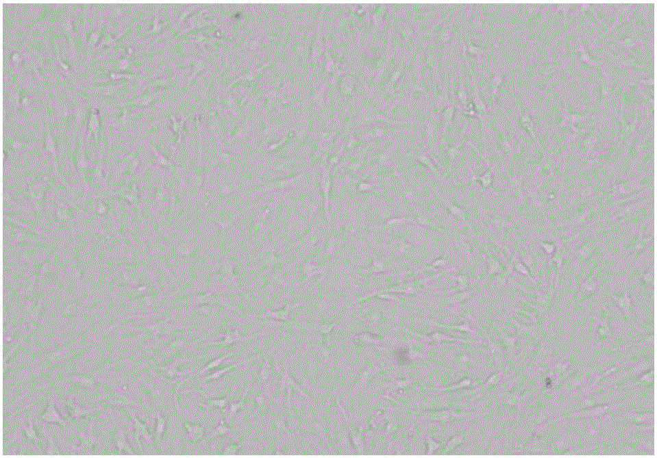 Preparation method of human primary cartilage cells with high yield rate