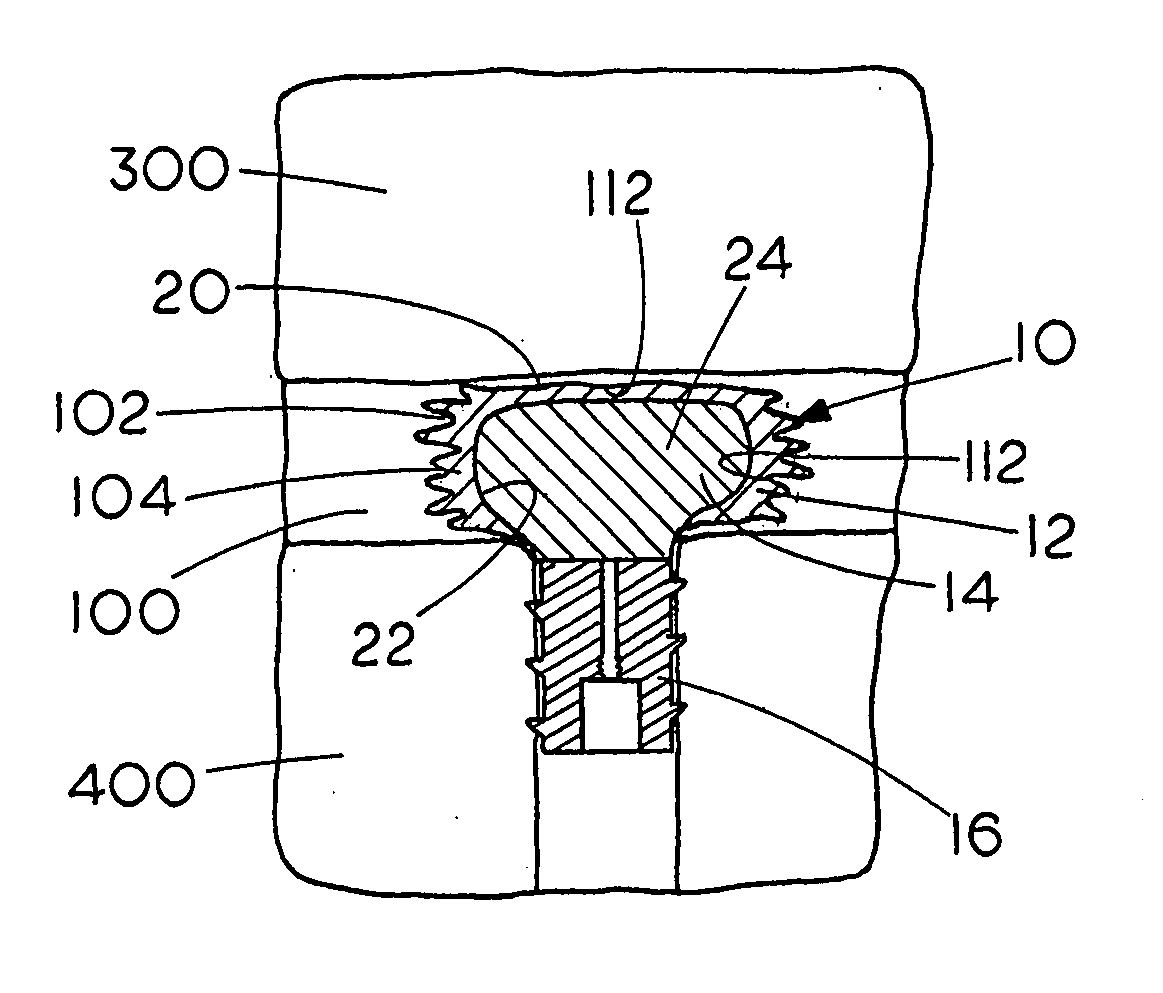 Prosthetic nucleus apparatus and method