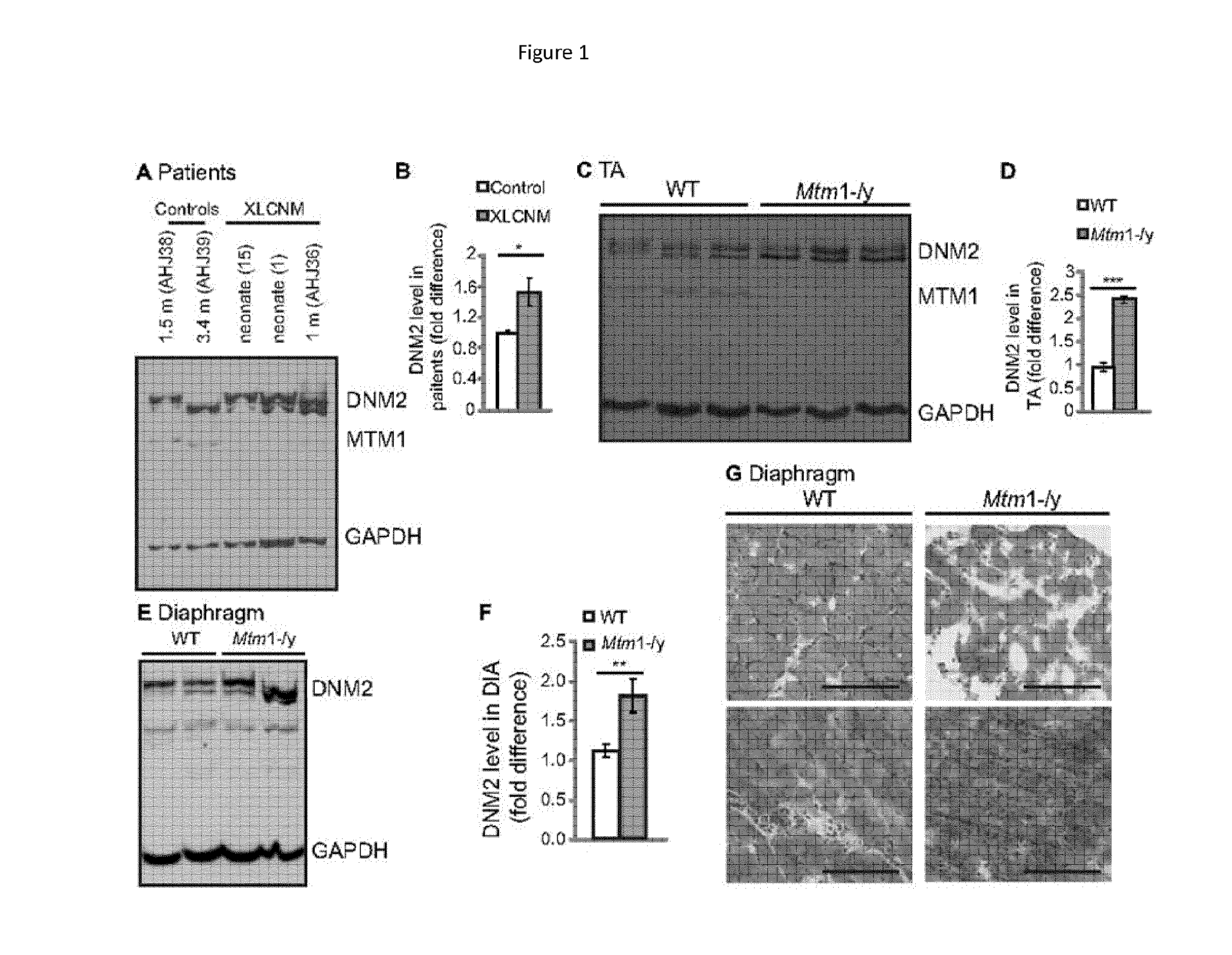 Dynamin 2 inhibitor for the treatment of centronuclear myopathies