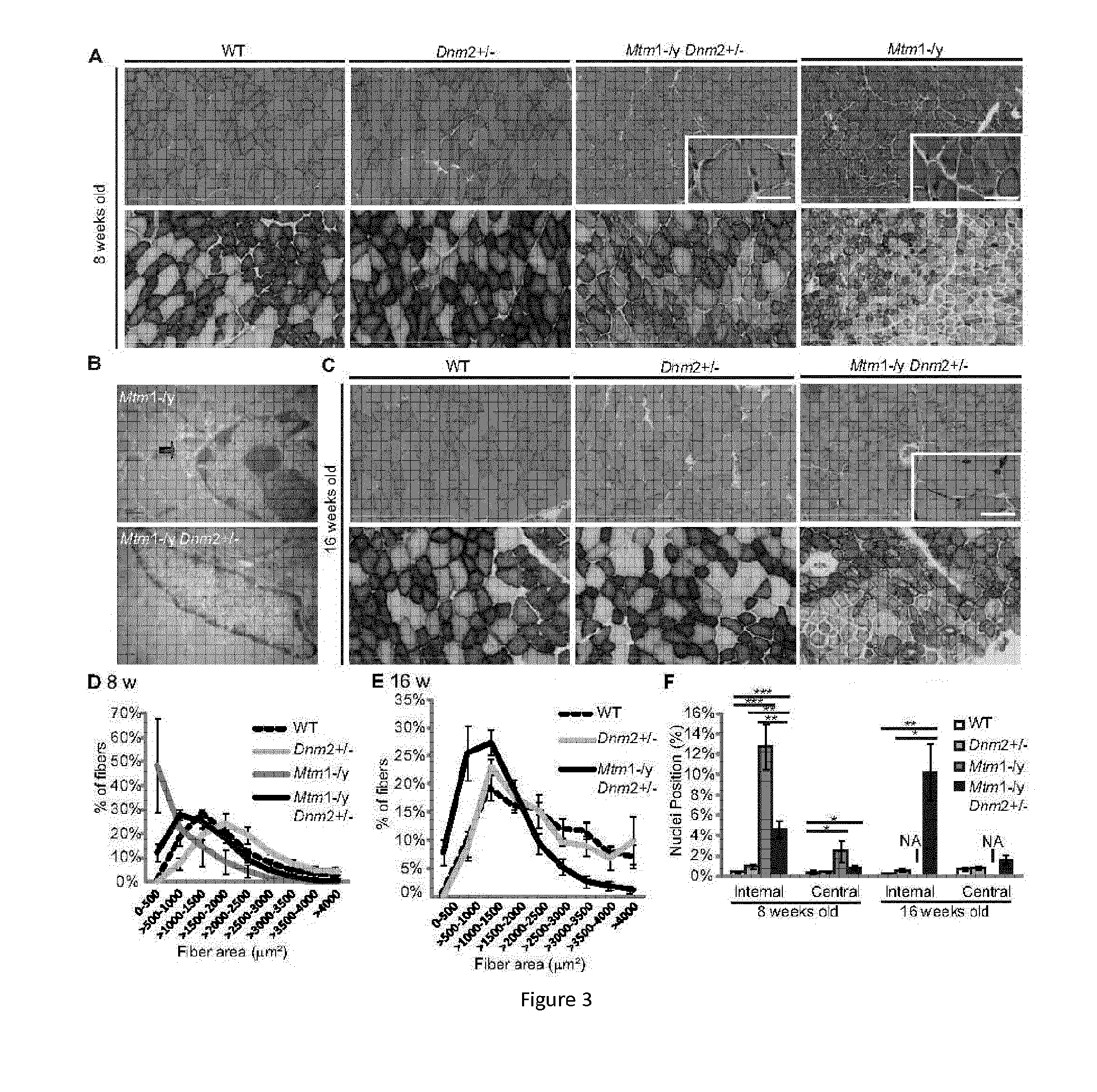 Dynamin 2 inhibitor for the treatment of centronuclear myopathies