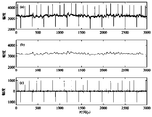 Low-frequency magnetotelluric data denoising method based on over-complete dictionary and compressed sensing reconstruction algorithm