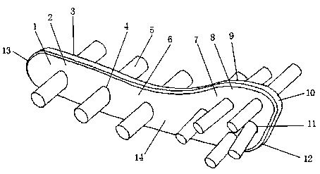 Fixation system for spinae scapulae during anatomy