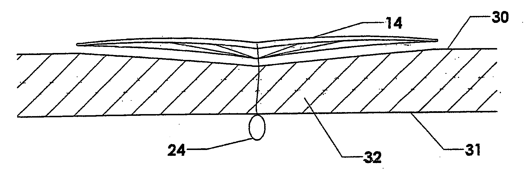 Methods and devices for anchoring to soft tissue